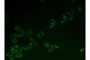 Figure. (HCCS antibody  (AA 1-268))