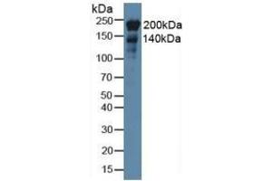 Detection of NES in Rat Heart Tissue using Monoclonal Antibody to Nestin (NES) (Nestin antibody  (AA 178-399))