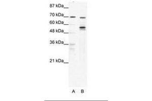 Image no. 1 for anti-DEAD (Asp-Glu-Ala-Asp) Box Polypeptide 55 (DDX55) (AA 92-141) antibody (ABIN6736047)