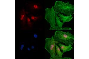 Smg1 Antibody staining A549 cells by IF/ICC.