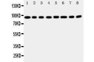 Western Blotting (WB) image for anti-Coagulation Factor VIII (F8) (AA 1264-1278), (Middle Region) antibody (ABIN3042924) (Factor VIII antibody  (Middle Region))