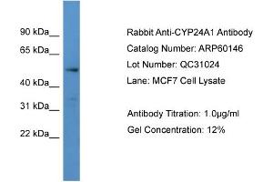 WB Suggested Anti-CYP24A1  Antibody Titration: 0. (CYP24A1 antibody  (C-Term))
