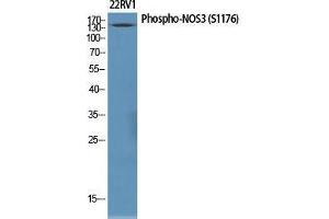 Western Blot (WB) analysis of specific cells using Phospho-NOS3 (S1177) Polyclonal Antibody. (ENOS antibody  (pSer1177))