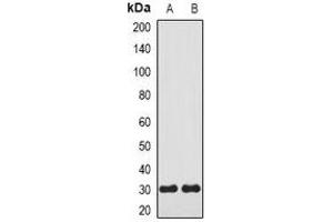 Western blot analysis of Carbonic Anhydrase 3 expression in mouse kidney (A), mouse lung (B) whole cell lysates.