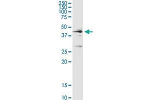 CTSD MaxPab rabbit polyclonal antibody. (Cathepsin D antibody  (AA 1-412))