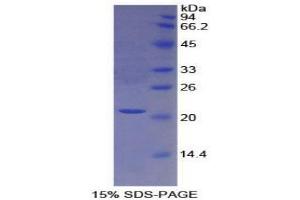 SDS-PAGE analysis of Human Protein S Protein. (PROS1 Protein)