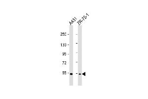 All lanes : Anti-MEFV Antibody (Center) at 1:1000 dilution Lane 1: A431 whole cell lysate Lane 2: ZR-75-1 whole cell lysate Lysates/proteins at 20 μg per lane. (MEFV antibody  (AA 418-445))