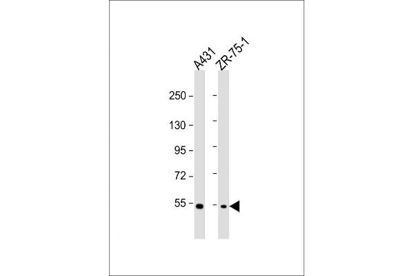 MEFV anticorps  (AA 418-445)