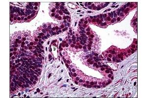 Immunohistochemistry (IHC) image for anti-Structural Maintenance of Chromosomes 1A (SMC1A) antibody (ABIN781888)