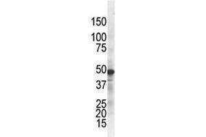 Western Blotting (WB) image for anti-Inhibitor of kappa Light Polypeptide Gene Enhancer in B-Cells, Kinase gamma (IKBKG) antibody (ABIN3031326)