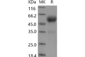 FZD5 Protein (Fc Tag)