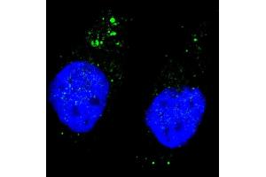 Fluorescent image of  cells stained with ULK1 (phospho ) antibody. (ULK1 antibody  (pSer556))