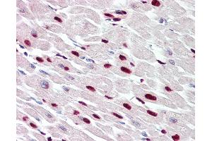 Anti-THAP5 antibody IHC of human heart. (THAP5 antibody  (AA 203-252))