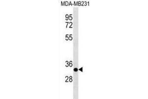 Western Blotting (WB) image for anti-Calpain, Small Subunit 2 (CAPNS2) antibody (ABIN3000891) (CAPNS2 antibody)
