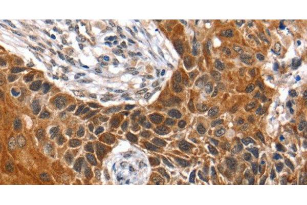 HOXB1 antibody
