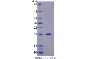 Image no. 1 for Dual Specificity Phosphatase 5 (DUSP5) (AA 1-135) protein (His tag) (ABIN4990494)