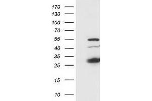 Image no. 8 for anti-Synovial Sarcoma, X Breakpoint 1 (SSX1) antibody (ABIN1501156) (SSX1 antibody)