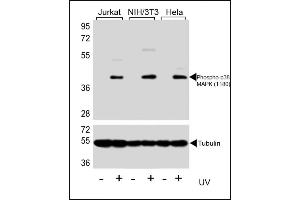 Western blot analysis of extracts from Jurkat , NIH/3T3 and Hela cell line, untreated or UV-treated, using Phospho-p38 PK  (upper) or Tubulin (lower). (MAPK14 antibody  (pThr180))