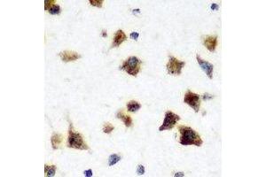 Immunohistochemical analysis of HuC staining in rat brain formalin fixed paraffin embedded tissue section. (HuC/ELAVL3 antibody)