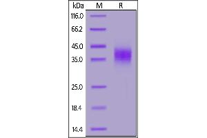 Rhesus macaque CD16, His Tag on  under reducing (R) condition. (FCGR3B Protein (AA 21-206) (His tag))