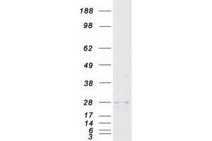 Validation with Western Blot (STMN4 Protein (Myc-DYKDDDDK Tag))