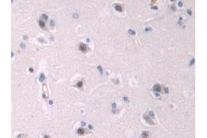 Detection of ENG in Human Cerebrum Tissue using Polyclonal Antibody to Endoglin (ENG) (Endoglin antibody  (AA 26-136))