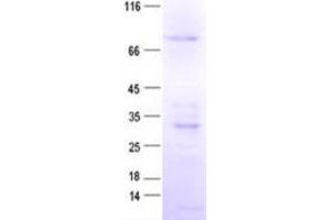 Validation with Western Blot (GAS2L1 Protein (His tag))