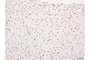 Formalin-fixed and paraffin embedded mouse embryo labeled with Rabbit Anti-LATS2 Polyclonal Antibody, Unconjugated  at 1:200 followed by conjugation to the secondary antibody and DAB staining (LATS1,2 (AA 641-740) antibody)