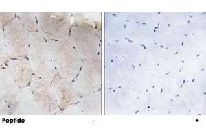 Immunohistochemistry analysis of paraffin-embedded human skeletal muscle tissue using COL12A1 polyclonal antibody . (COL12A1 antibody)