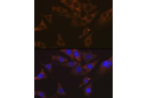Immunofluorescence analysis of NIH-3T3 cells using V Rabbit mAb (ABIN7271312) at dilution of 1:100 (40x lens). (VAMP1 antibody)
