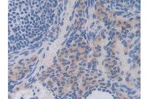 Detection of IL35 in Mouse Ovary Tissue using Polyclonal Antibody to Interleukin 35 (IL35) (Interleukin 35 antibody  (AA 23-215))
