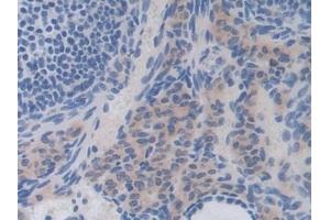 Detection of IL35 in Mouse Ovary Tissue using Polyclonal Antibody to Interleukin 35 (IL35)