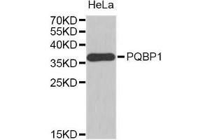Western Blotting (WB) image for anti-Polyglutamine Binding Protein 1 (PQBP1) (AA 1-265) antibody (ABIN1682273) (PQBP1 antibody  (AA 1-265))