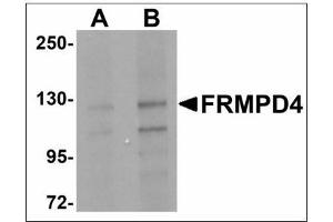 Western blot analysis of FRMPD4 in SK-N-SH cell lysate with FRMPD4 antibody at (A) 1 and (B) 2 µg/ml.