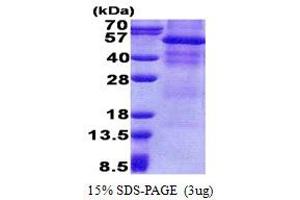SDS-PAGE (SDS) image for Osteoactivin (GPNMB) (AA 22-474) protein (His tag) (ABIN5853180)
