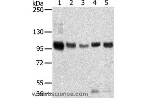 Western blot analysis of Mouse brain and human brain tissue, human prostate tissue, human fat and placenta tissue, using SORT1 Polyclonal Antibody at dilution of 1:200 (Sortilin 1 antibody)