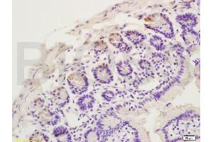 Formalin-fixed and paraffin embedded rat intestine labeled with Anti CCR10 Polyclonal Antibody, Unconjugated (ABIN733313) at 1:200 followed by conjugation to the secondary antibody and DAB staining (CCR10 antibody  (AA 1-52))