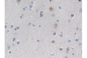 Immunohistochemistry (IHC) image for anti-Proteasome (Prosome, Macropain) Subunit, beta Type, 6 (PSMB6) (AA 2-239) antibody (ABIN7436234)