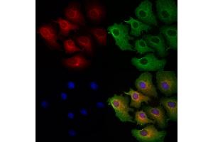 ABIN6263284 and ABIN6272925 staining Hela cells by IF/ICC.