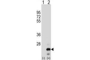 Western blot analysis of TNFSF18 (arrow) using rabbit polyclonal TNFSF18 Antibody (Center) .
