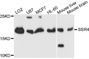 Western blot analysis of extracts of HeLa cells, using SSR4 antibody. (SSR4 antibody)