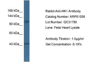 Western Blotting (WB) image for anti-Hexokinase 1 (HK1) (Middle Region) antibody (ABIN2788662) (Hexokinase 1 antibody  (Middle Region))