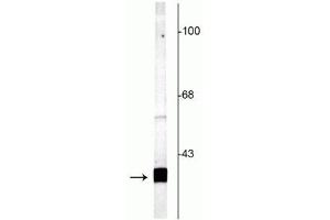 Western blot of rat cortical lysate showing specific labeling of the ~25 kDa SNAP25 protein. (SNAP25 antibody  (C-Term))