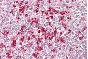 Immunohistochemistry with Spleen tissue at an antibody concentration of 5µg/ml using anti-ZKSCAN4 antibody (ARP39384_P050) (ZKSCAN4 antibody  (N-Term))
