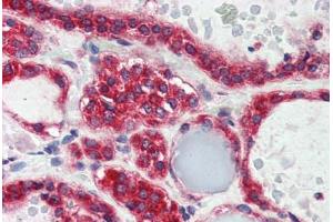 Human Thyroid (formalin-fixed, paraffin-embedded) stained with LPIN3 antibody ABIN337225 at 2. (LPIN3 antibody  (AA 149-160))