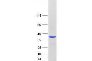VSX1 Protein (Transcript Variant 2) (Myc-DYKDDDDK Tag)