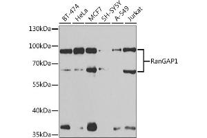 Western blot analysis of extracts of various cell lines, using RanG antibody (ABIN6128613, ABIN6146681, ABIN6146683 and ABIN6217306) at 1:1000 dilution. (RANGAP1 antibody  (AA 398-587))