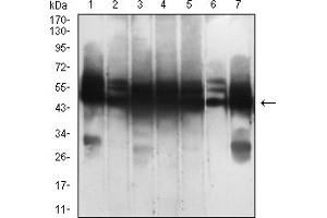 Western Blotting (WB) image for anti-Keratin 18 (KRT18) (AA 1-150) antibody (ABIN7193470)