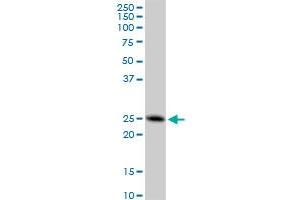 FAM3C monoclonal antibody (M05), clone 3A3. (FAM3C antibody  (AA 25-227))