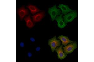 ABIN6257814 and ABIN6275282 staining Hela cells by IF/ICC.